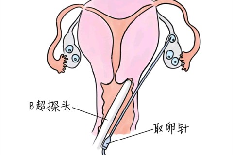 http://zhongshan.huochezhan.net/post/205.html|中山供卵助孕