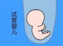 培养中山捐卵宝宝艺术细胞的小技巧